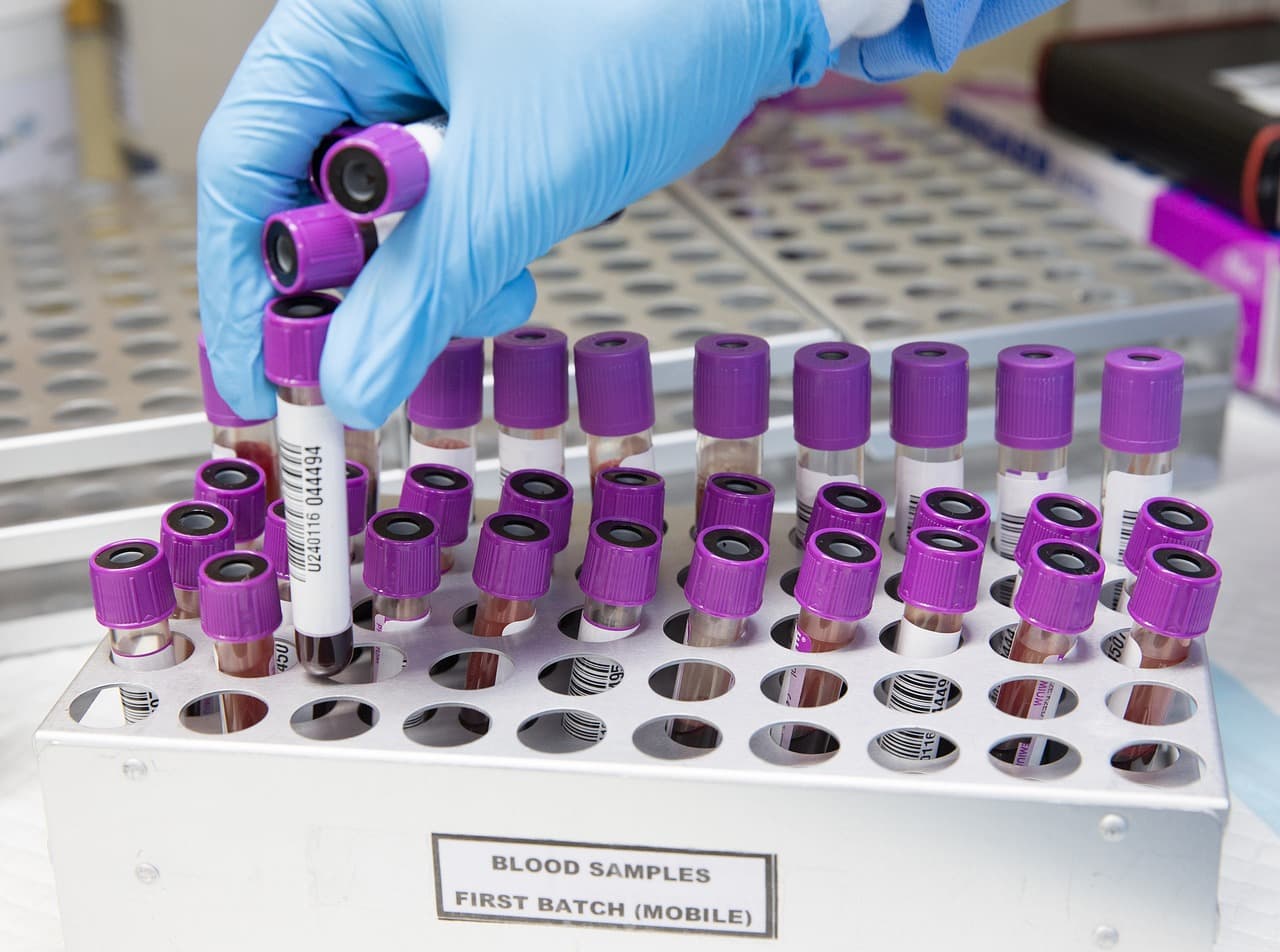 Beschriftete Probenröhrchen mit violetten Verschlüssen stehen in einem Laborständer